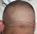 Scar Cover-up hair piece